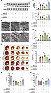 Lnc-AI662270 alleviates post-MI cardiac dysfunction via GRP94 and mitochond