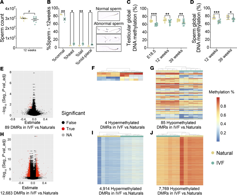 Sperm parameters and testicular DNA methylation.
(A) Sperm count using a...