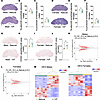 Multigenerational impacts of IVF in placenta.