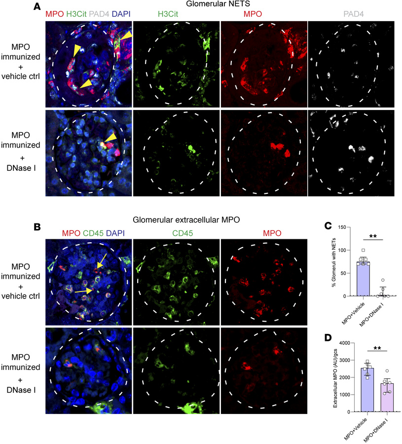 DNase I treatment reduces NET formation and deposition of extracellular ...