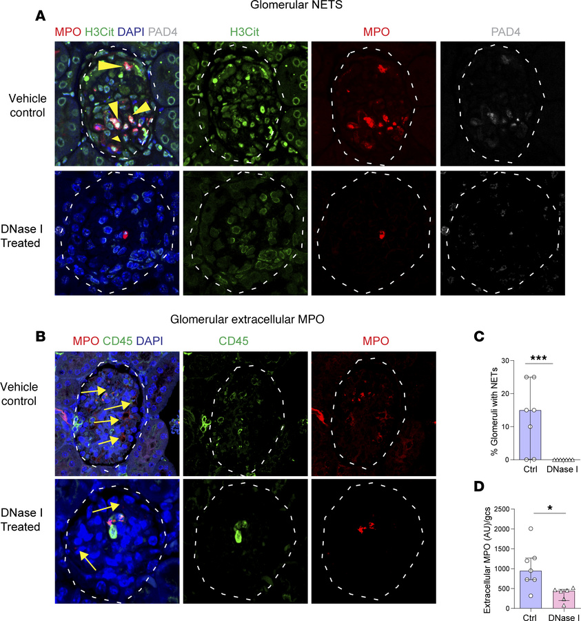 NET formation is abolished by DNase I treatment in a passive ANCA-depend...