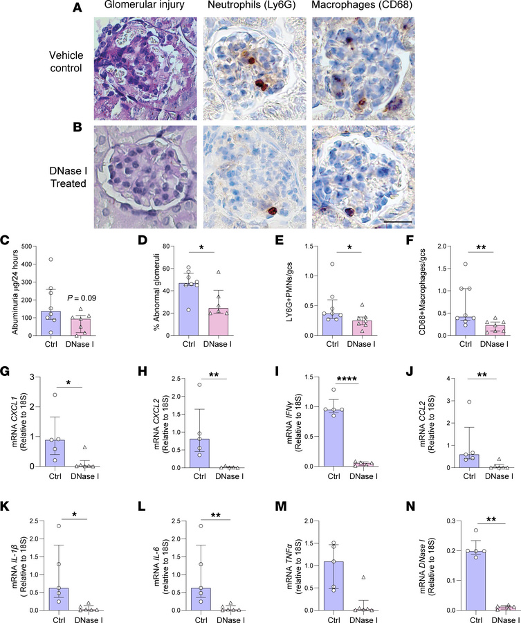 DNase I treatment reduces glomerular injury and inflammatory gene expres...