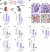 rhDNase I treatment reduces histological glomerular injury, leukocyte recru