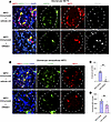 DNase I treatment reduces NET formation and deposition of extracellular MPO