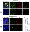 NET formation is abolished by DNase I treatment in a passive ANCA-dependent