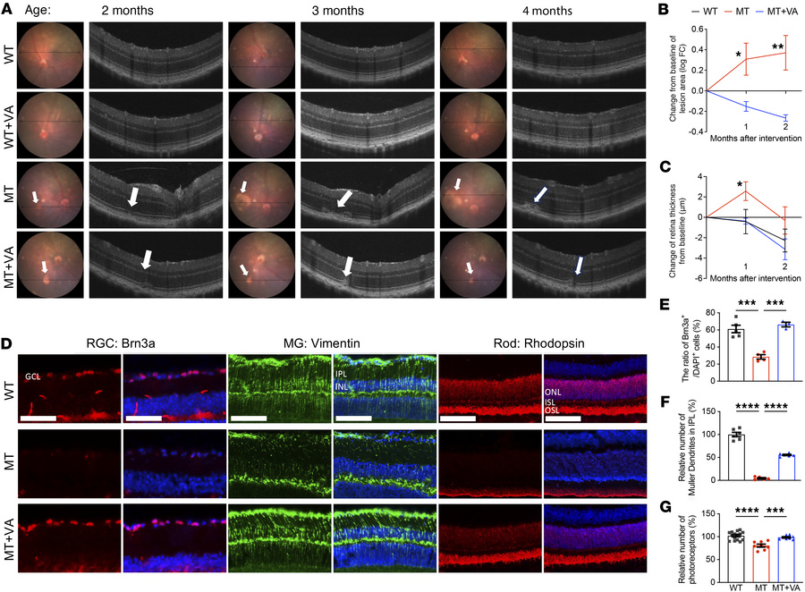 The recovery of retinal deficiency with VA supplementation.
(A) Image-gu...