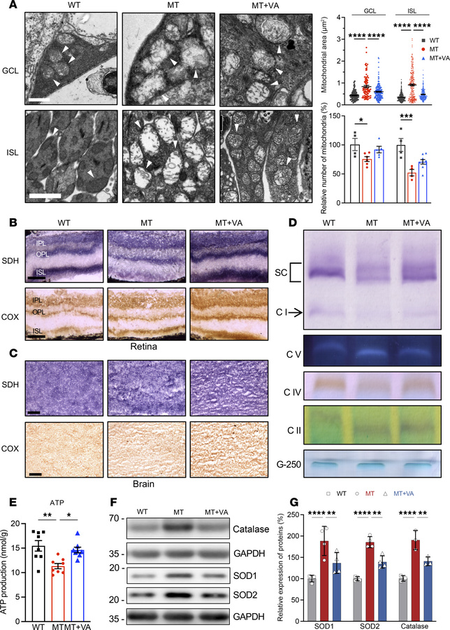 Mitochondrial morphology and function.
(A) Representative transmission e...