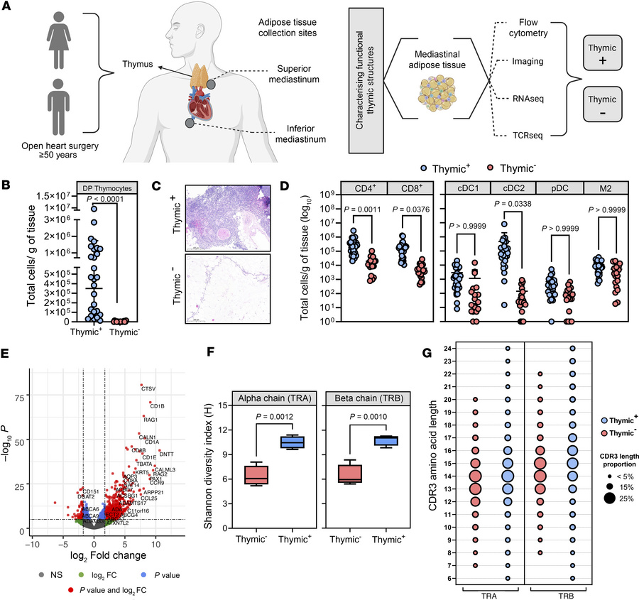 Characterizing immune cellular landscape and function of thymic structur...