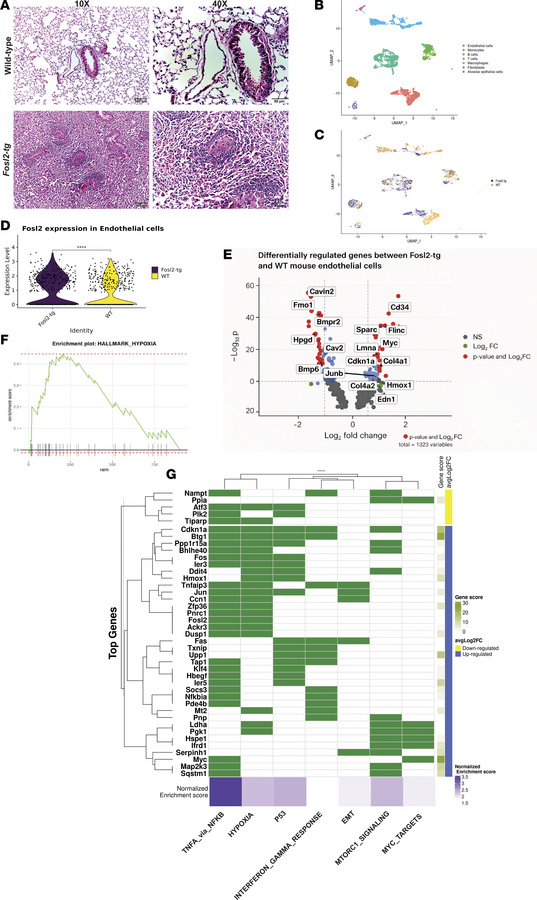 Vascular ECs from Fosl2tg mice have dysregulated gene expression.
(A) H&...