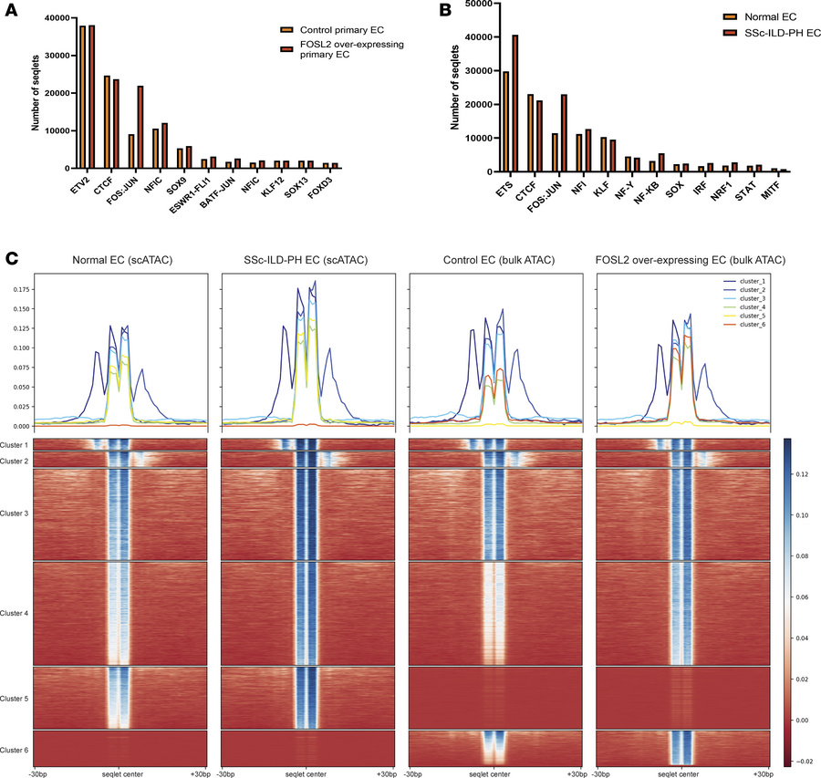 ChromBPNet identified FOS:JUN (AP-1) motifs to be expressed in SSc-ILD-P...