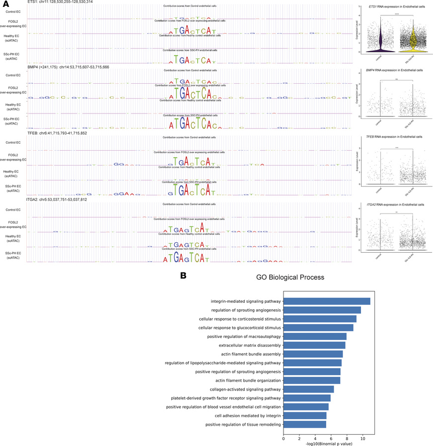 Parallel AP-1 binding in SSc-ILD-PH and FOSL2-overexpressing endothelial...