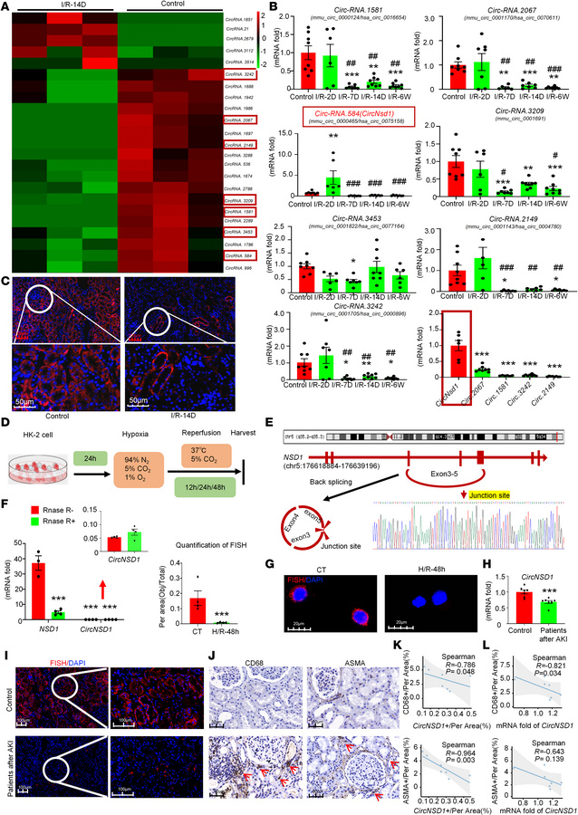 
CircNSD1 expression is suppressed in vivo, in vitro, and in patients.
(...