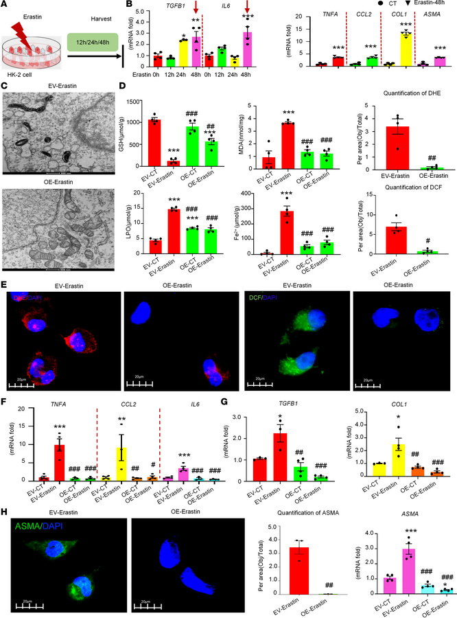 Overexpression of CircNSD1 decreases ferroptosis, inflammation, and fibr...