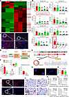 CircNSD1 expression is suppressed in vivo, in vitro, and in patients.
