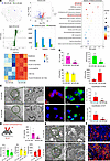 CircNSD1 inhibits ferroptosis in AKI-to-CKD in vivo and in vitro.