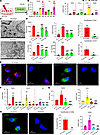 Overexpression of CircNSD1 decreases ferroptosis, inflammation, and fibrosi