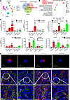 Overexpression of CircNSD1 downregulated ACSL4 and SLC39A14 by H3K36 methyl