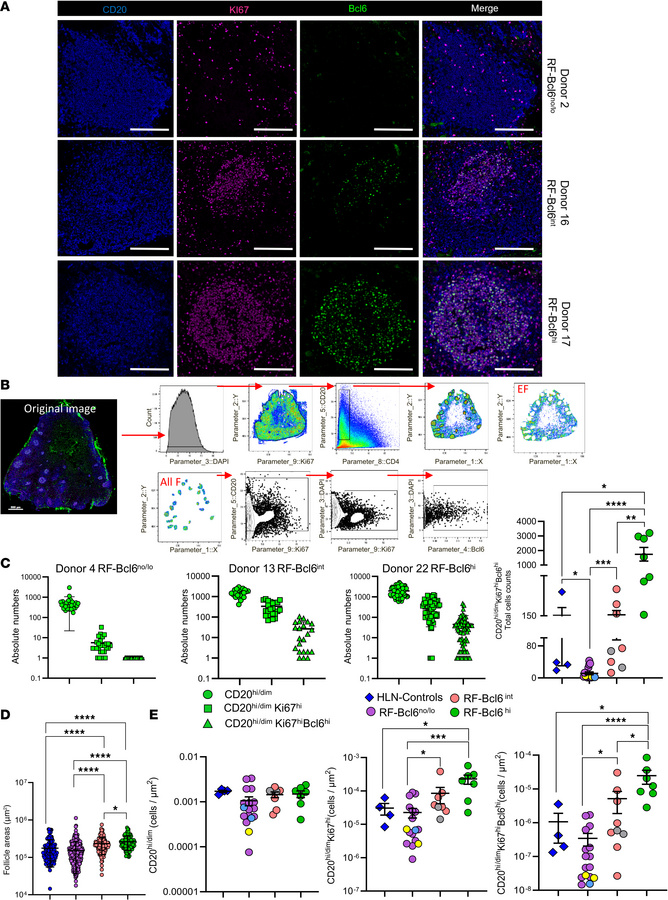 COVID-19 infection induces diverse and heterogeneous reactive follicles ...