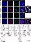 COVID-19 infection reveals a disconnection in F/GC immunoreactivity between