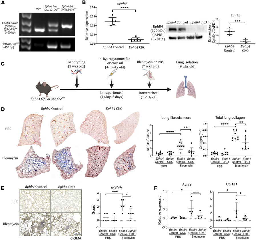 
Ephb4 CKO mice exhibit a protective phenotype against the development o...