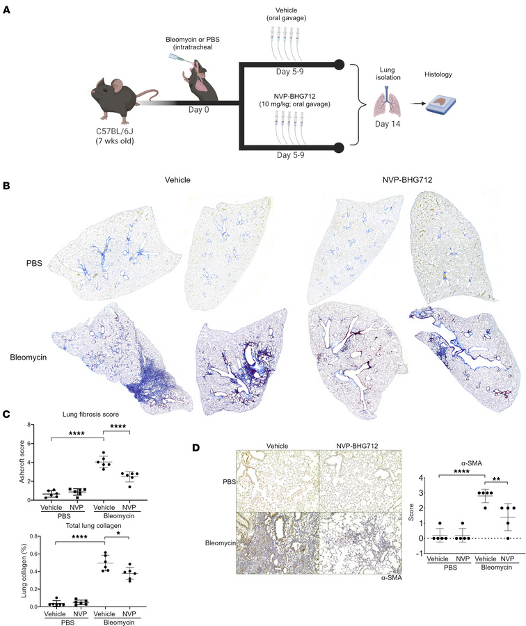 Pharmacological inhibition of EphB4 protects against development of PF i...