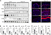 DNA Damage accumulation from reduced PARP activity in Nampt-cKO mice.