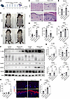 UVB-enhanced epidermal inflammation in Nampt-cKO mice.