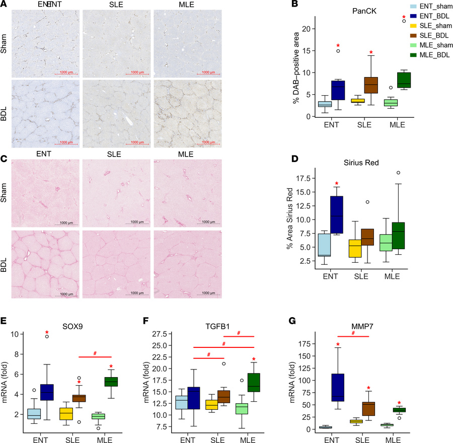 BDL promotes liver injury within all diet groups.
(A and B) Ductular rea...