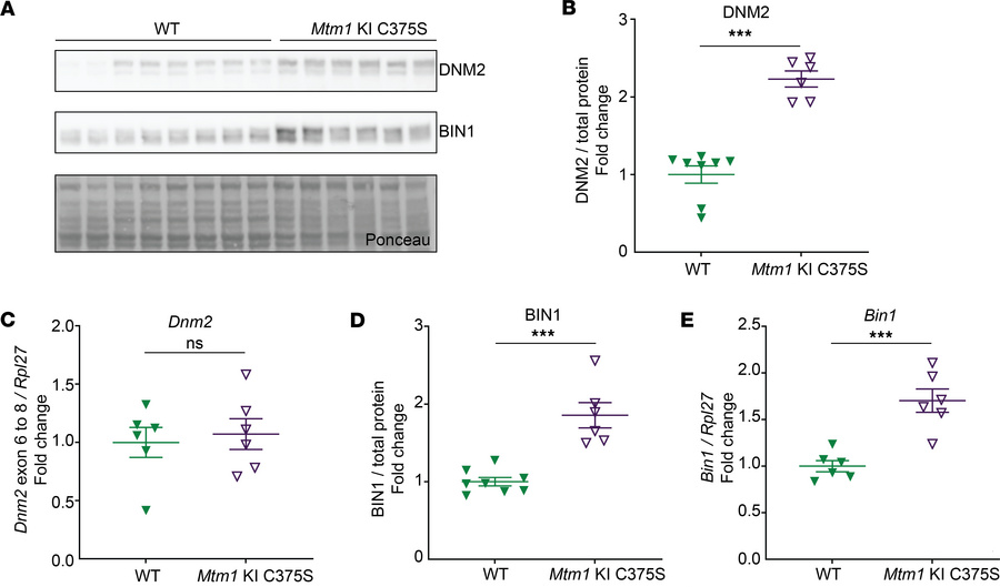 DNM2 and BIN1 protein levels are affected in the muscles of Mtm1-KI C375...
