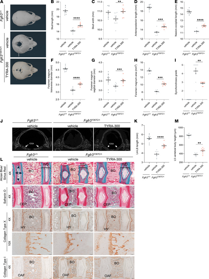 TYRA-300 improved the size and shape of the axial skeleton in Fgfr3Y367C...