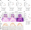 TYRA-300 increased bone length and reduced FGFR3 signaling within the growt