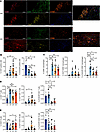 Landscape of relationship between cholinergic components and immune charact