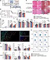 α7nAChR on B cells inhibits their role in exacerbating VMC severity and Th1