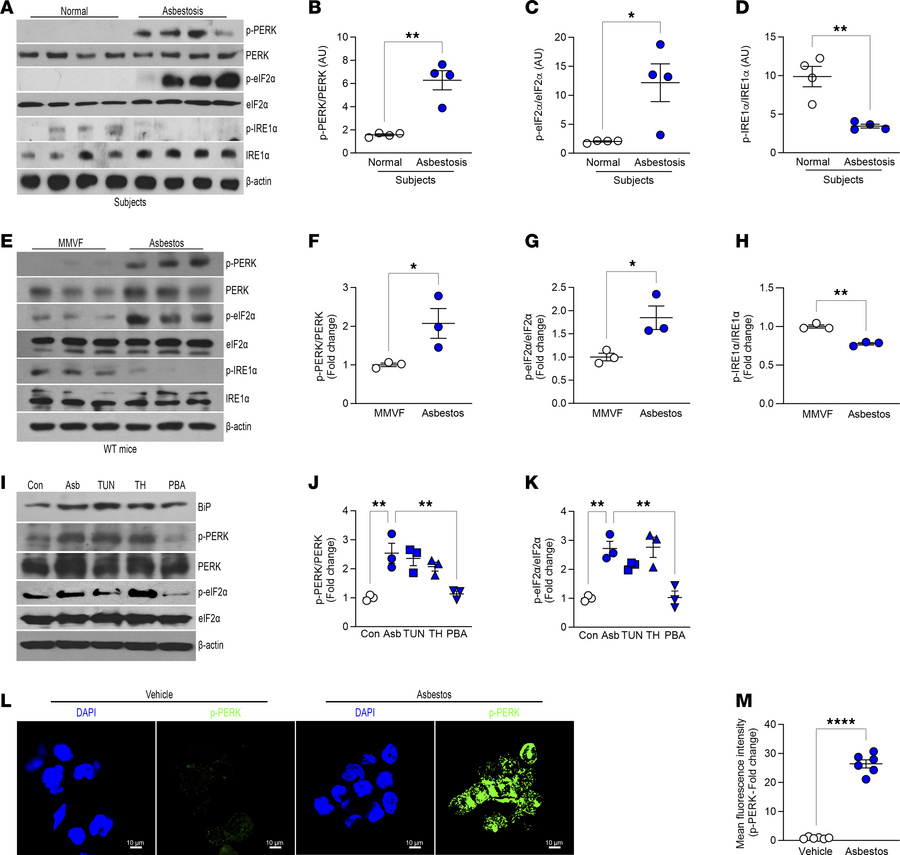 Asbestos activates PERK in lung macrophages.
(A) Lung macrophages from n...