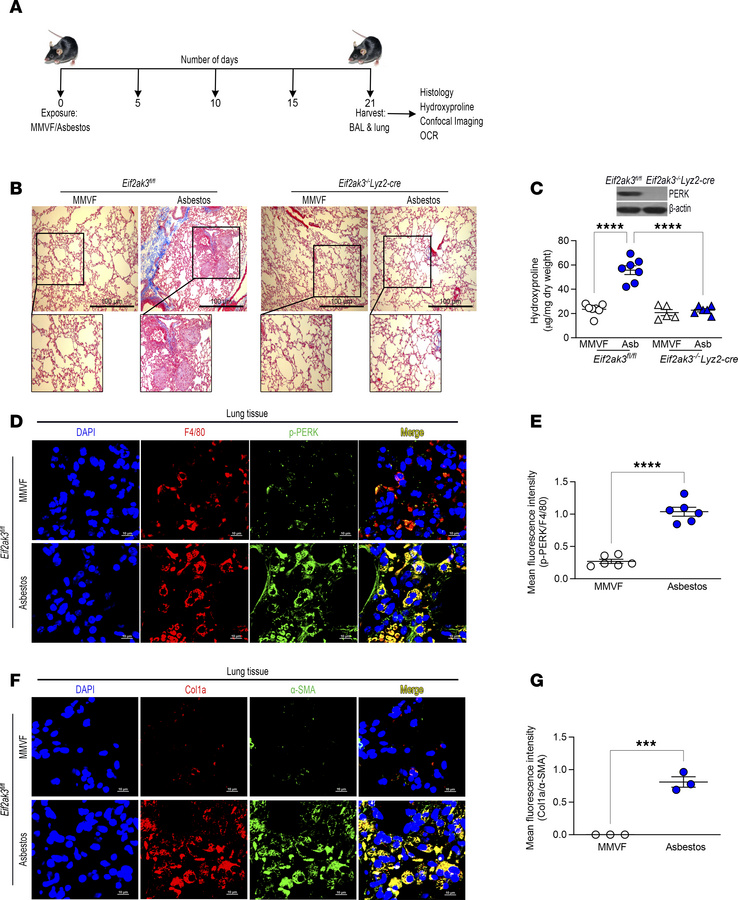 PERK is required for asbestos-induced lung fibrosis.
(A) Schematic repre...