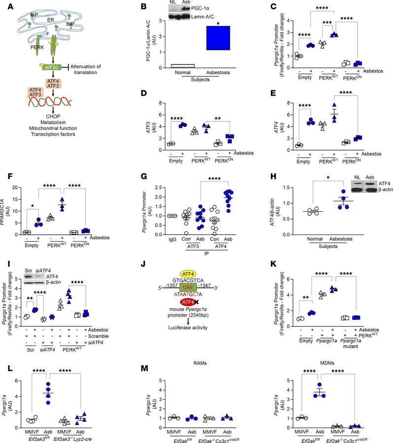 PERK activates PGC-1α by increasing ATF4 in lung macrophages.
(A) Schema...