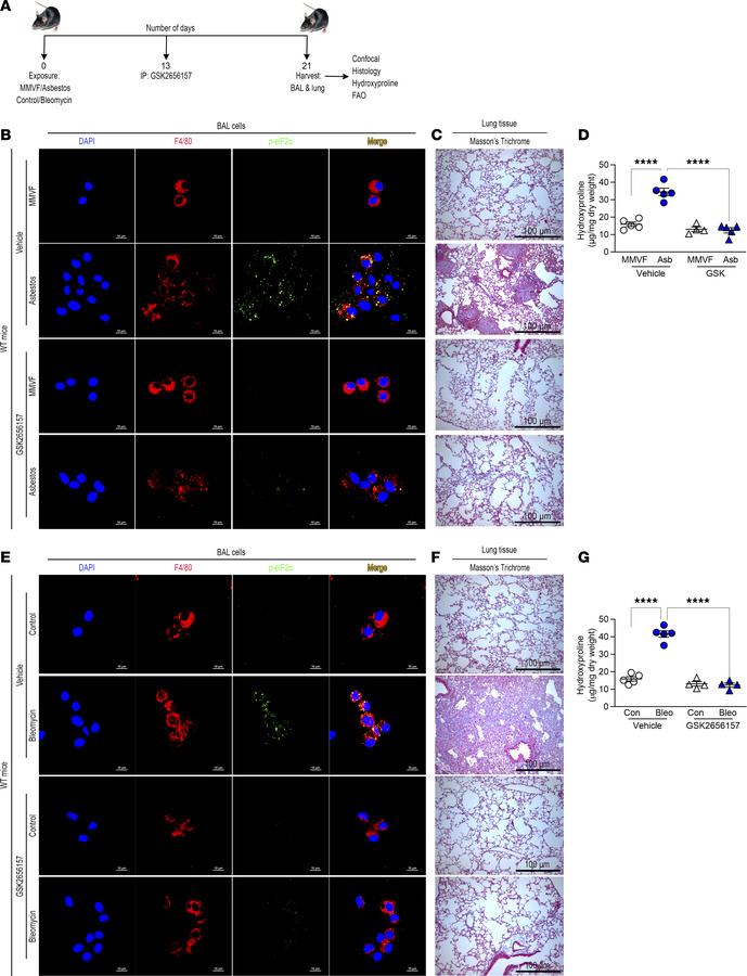 Pharmacological inhibition of PERK reverses established lung fibrosis.
(...