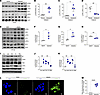 Asbestos activates PERK in lung macrophages.