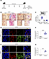 PERK is required for asbestos-induced lung fibrosis.