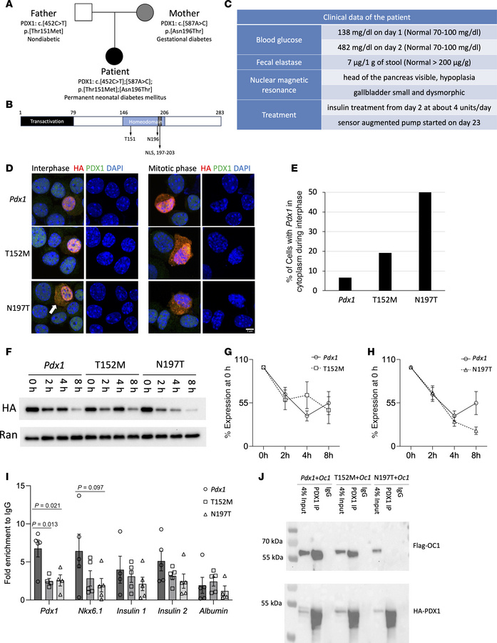 
PDX1 N196T missense mutation identified in a pediatric patient with neo...