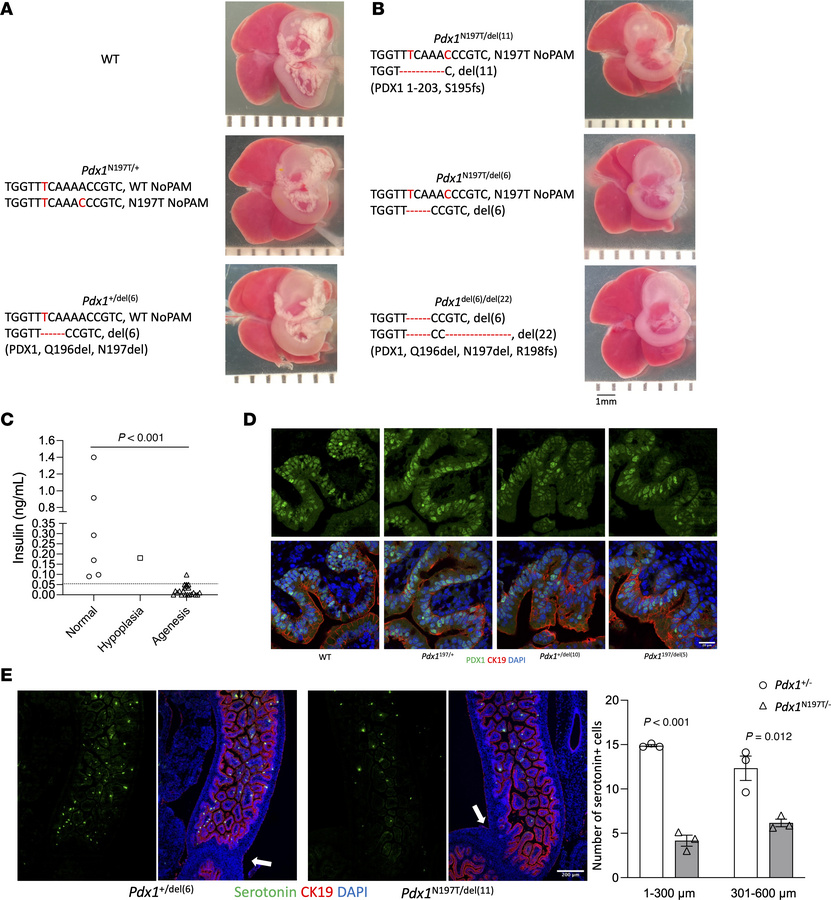 Mouse Pdx1 N197T causes pancreas agenesis and reduced generation of duod...
