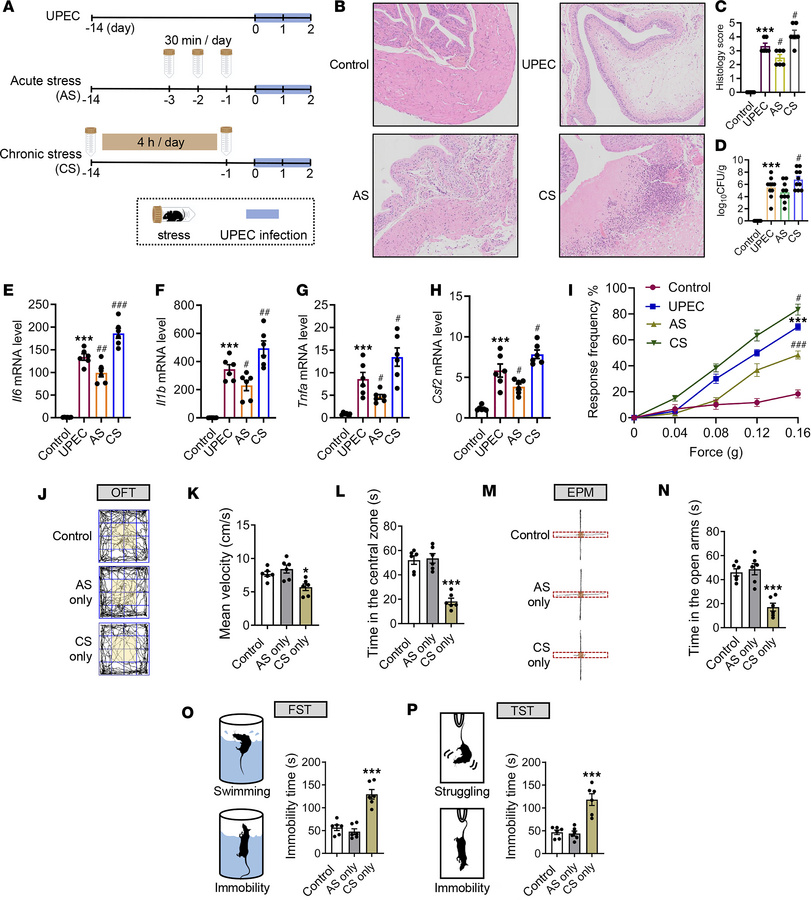 Acute and chronic stress induce divergent effects on UTI-induced bladder...