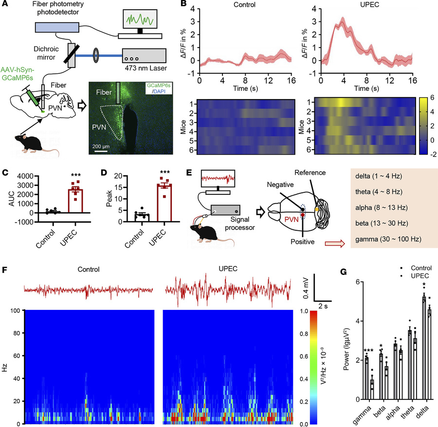 UPEC-induced bladder inflammation upregulates neuronal activity in the P...