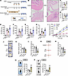 Acute and chronic stress induce divergent effects on UTI-induced bladder in