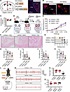 Chemogenetic activation of PVN neurons attenuates bladder inflammation duri