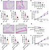 ILC2 cells exacerbate inflammation and voiding behavior through Csf2 secret