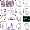 ANGPTL8 expression increases with age in BM during skeletal aging.