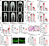 Angptl8-Nestin-creTg mice display lower bone mass and higher fat accumulati
