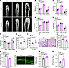 Angptl8–/– mice exhibit higher bone mass and lower BMAT accumulation.