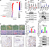 ANGPTL8 regulates MSC differentiation via the Wnt/β-catenin signaling pathw